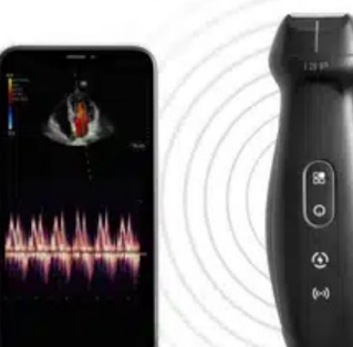 Mindray Introduces Groundbreaking 2-in-1 Handheld Ultrasound Device with Multi-device Connectivity