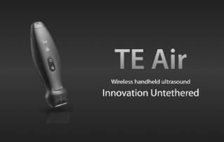 Mindray revoluciona la forma de usar la ecografía  con TE Air, su primer equipo de ecografía portátil inalámbrico