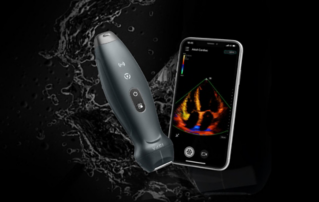 Mindray opent online winkel voor draadloos handheld echografiesysteem TE Air