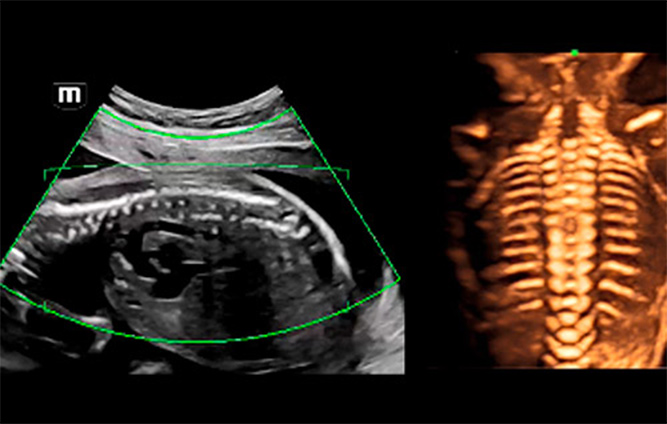 Happy Hands Sonogram cadre échographie de Dooky