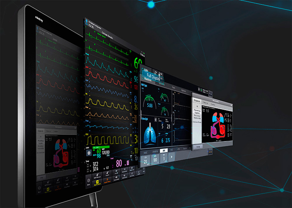 Screen Trends Patient monitoring decision support