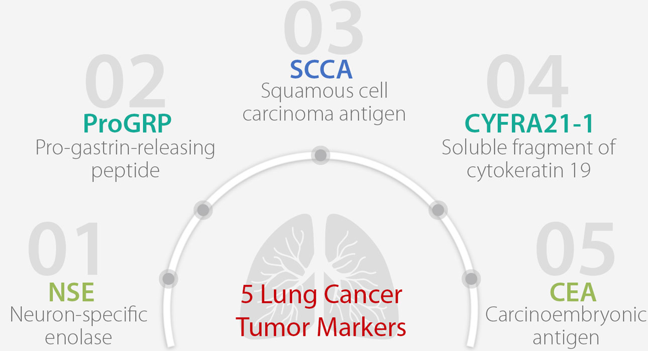 The 5 Tumor Markers You Must Know About Lung Cancer Mindray Global
