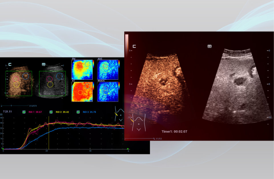 ecr-2024-ceus-session