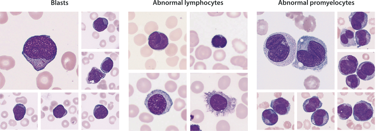 The image of abnormal cells under MC-80