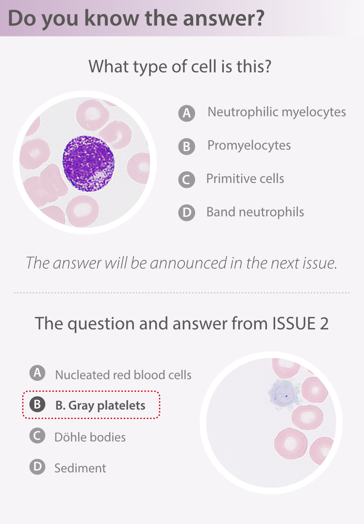 lymphocytic leukemia icd 10 code