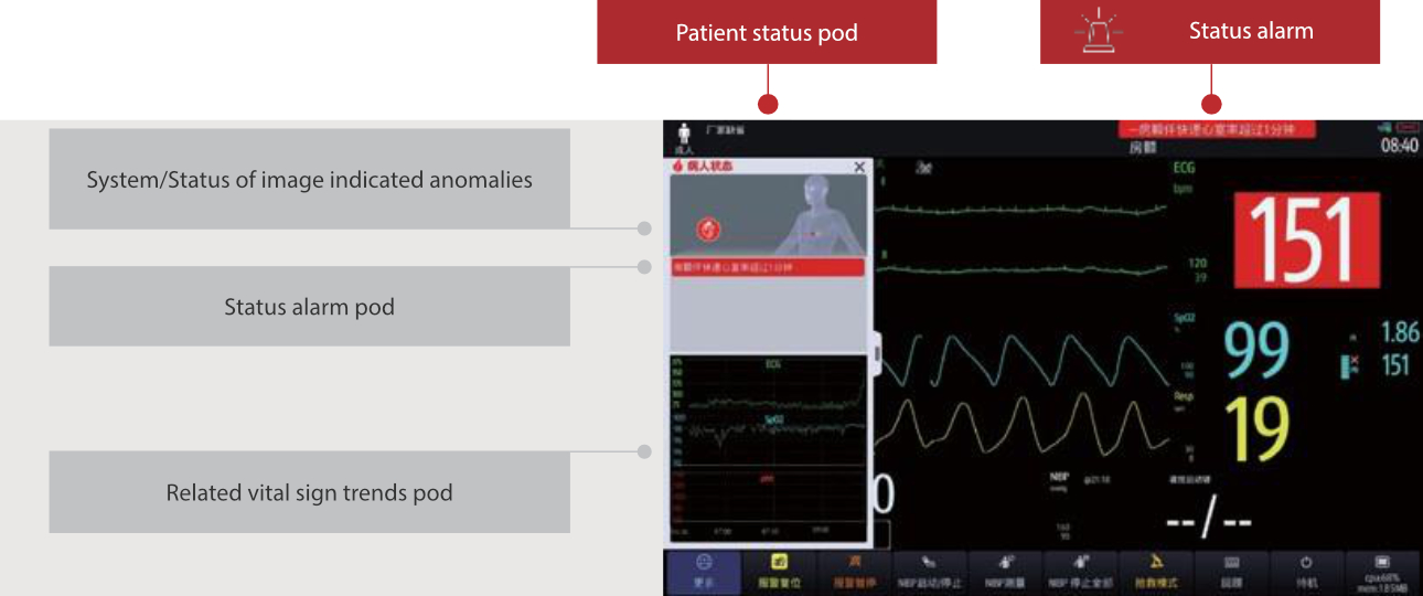 atrial-fibrillation-fig10-pc