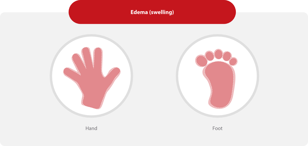 autoimmune-thyroid-fig11-pc