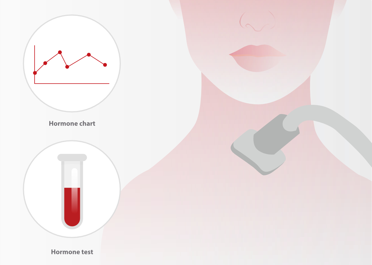 autoimmune-thyroid-fig13-pc