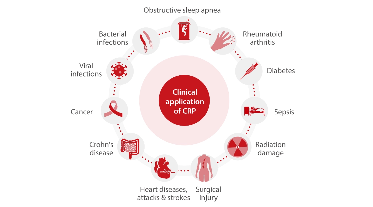 medical-application-of-c-reactive-protein-fig3-pc