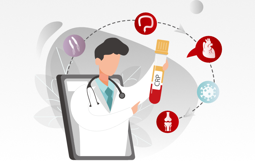 medical-application-of-c-reactive-protein-kv-pc