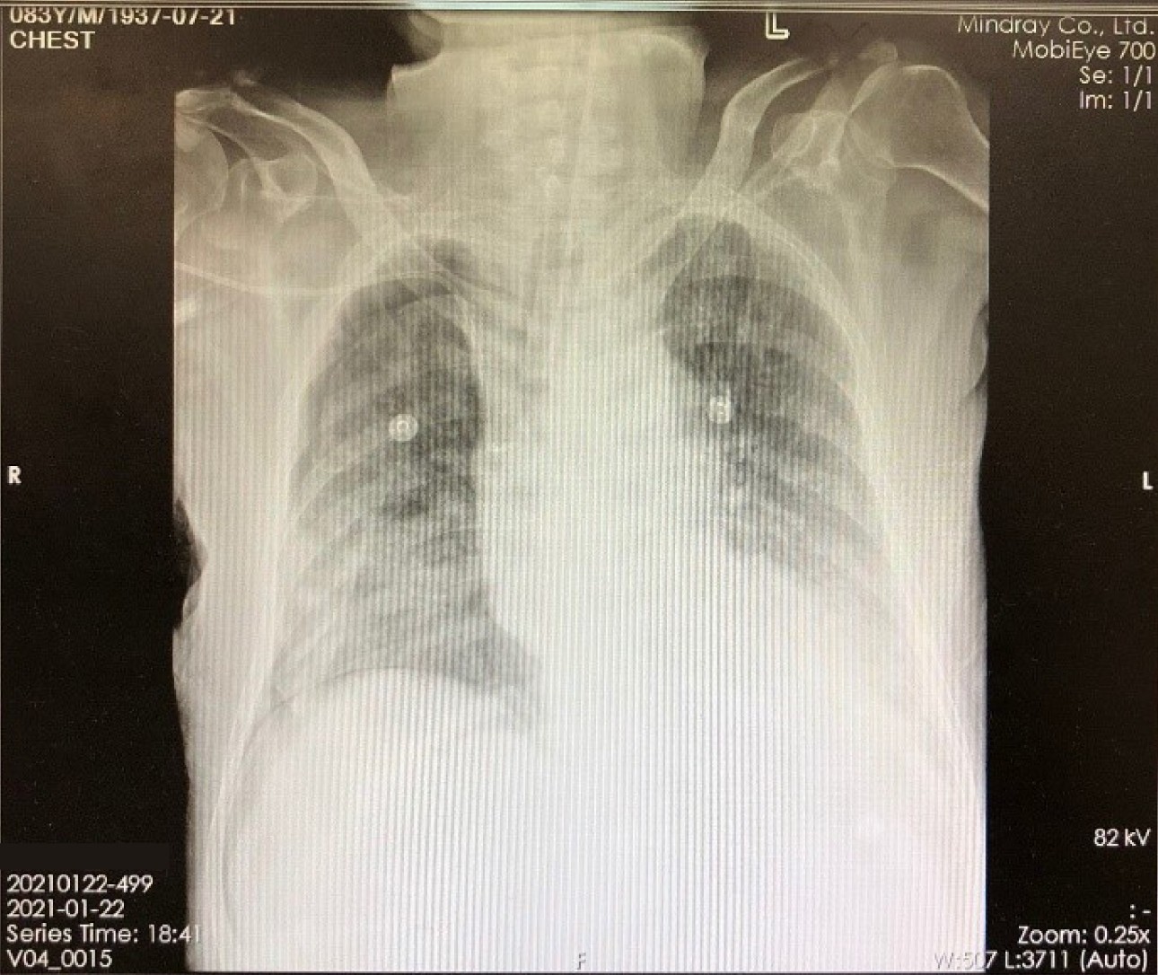 potential-shock-in-icu-fig1-pc