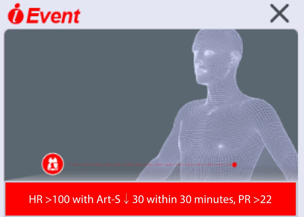 potential-shock-in-icu-fig2-pc