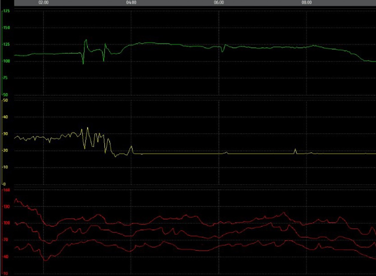 potential-shock-in-icu-fig3-pc