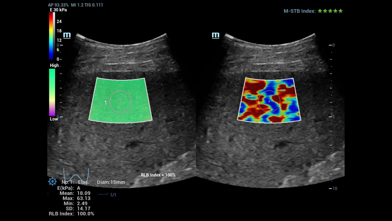 hifr-ceus-liver-fig3-pc
