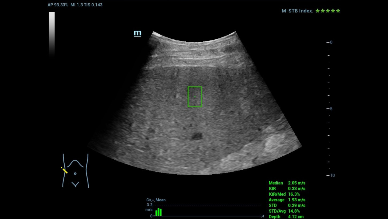 hifr-ceus-liver-fig4-pc