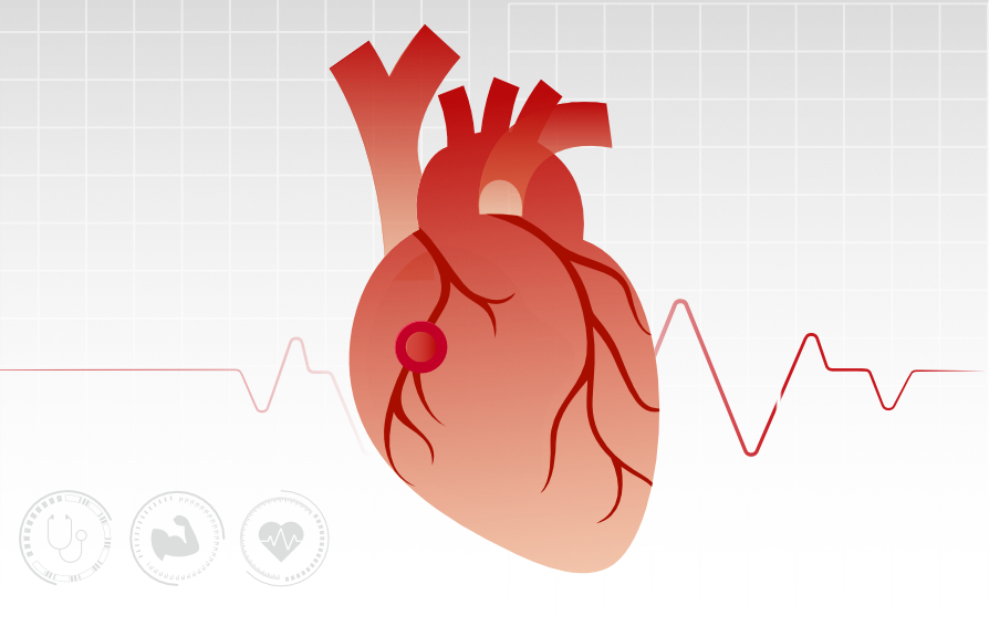hs-cTnl: Empowering Heart Risk Assessment