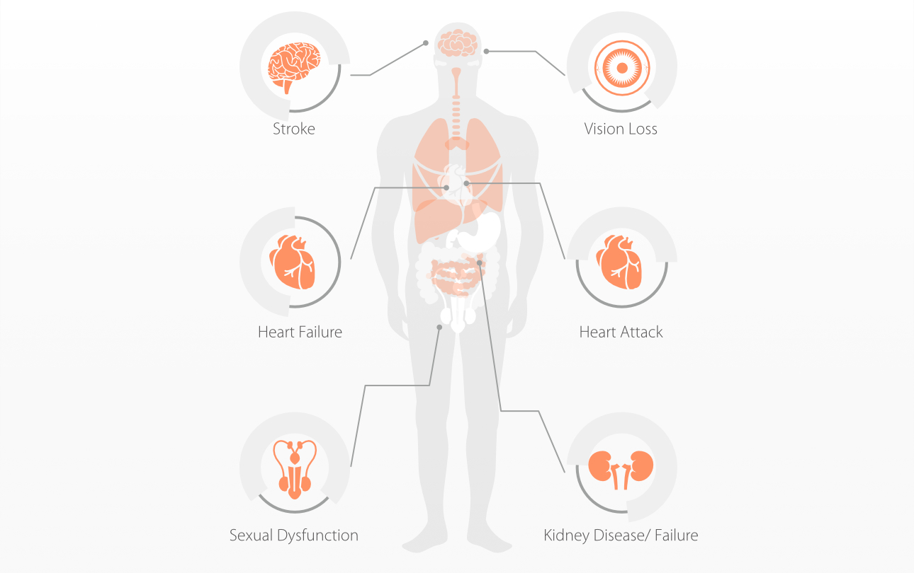 hypertension-check-fig2-pc