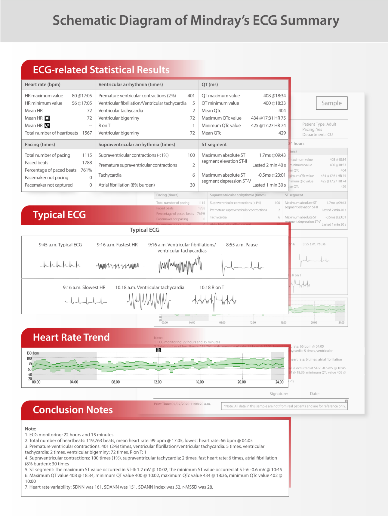 intuitive-ecg-fig5-pc