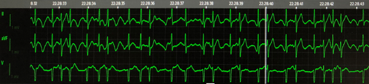 istatus-warning-fig1-pc