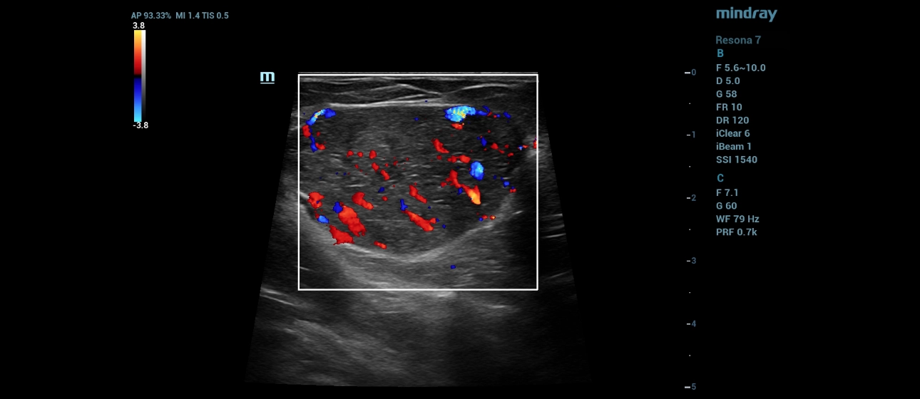 mammary-gland-fig3-pc