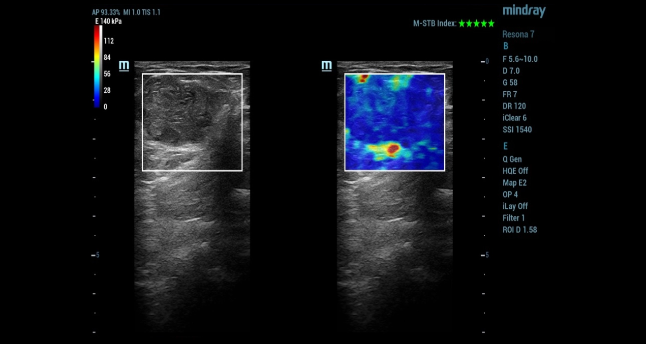 mammary-gland-fig4-pc