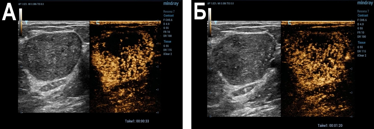 mammary-gland-fig5-pc