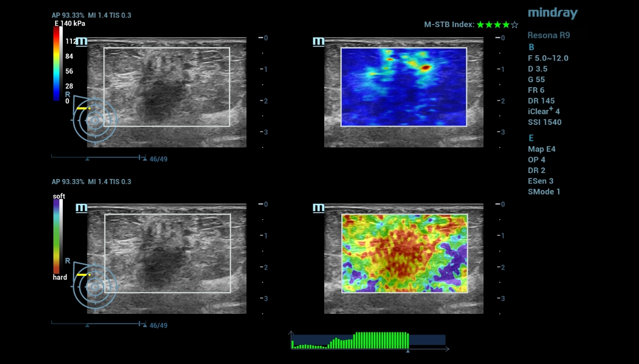 multi-parametric-imaging-fig8-pc