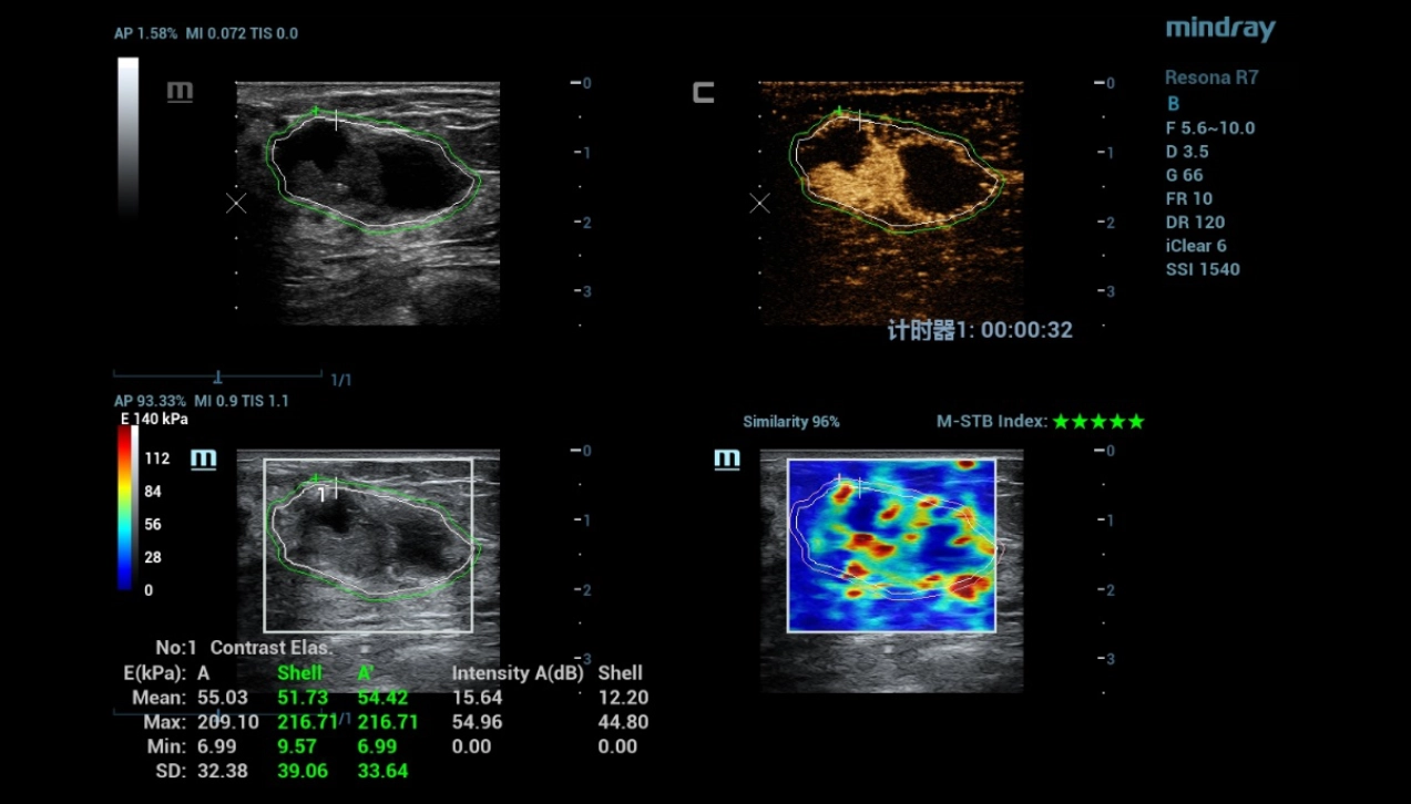 multi-parametric-imaging-fig9-pc
