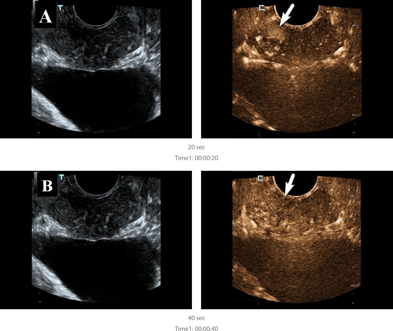 multiparametric-ultrasound-fig4-pc