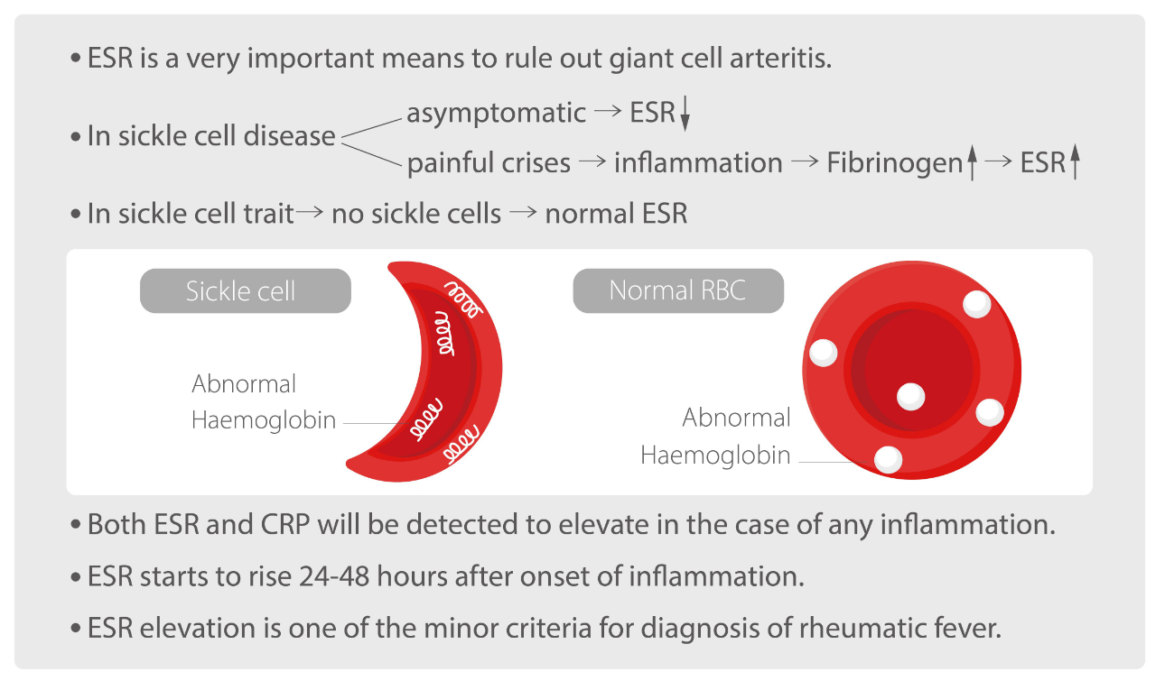 Erythrocyte Sedimentation Rate (ECR) Test: Purpose, Procedures and Test  Results