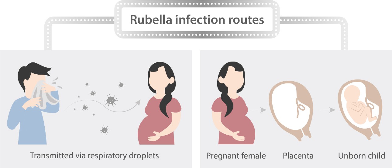 368 Rubella In Pregnancy Journal Of Obstetrics And 44 OFF
