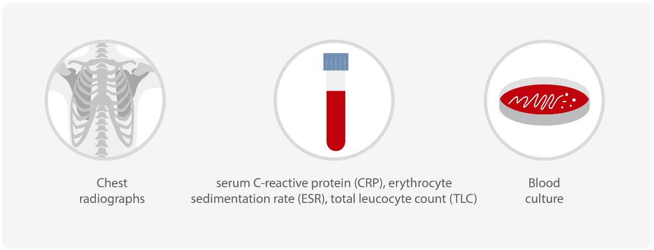 ESR vs. CRP: Blood Tests for Detecting Inflammation