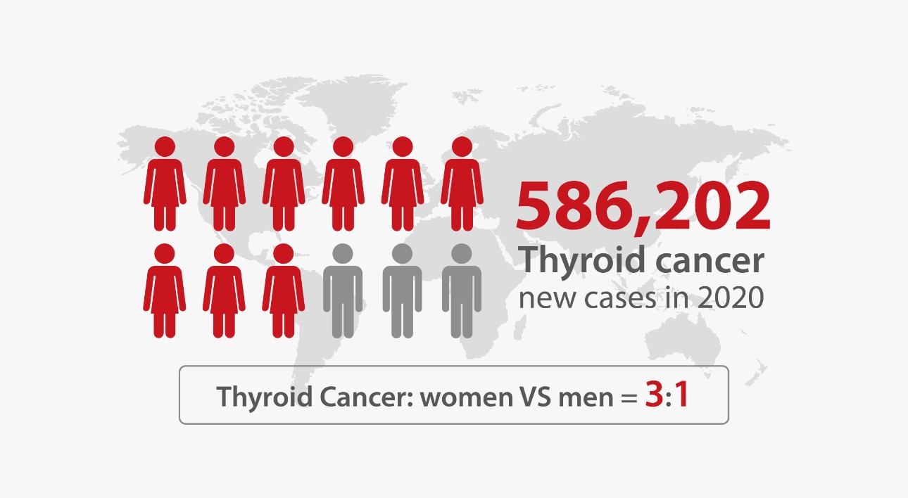 Thyroid cancer new cases in 2020