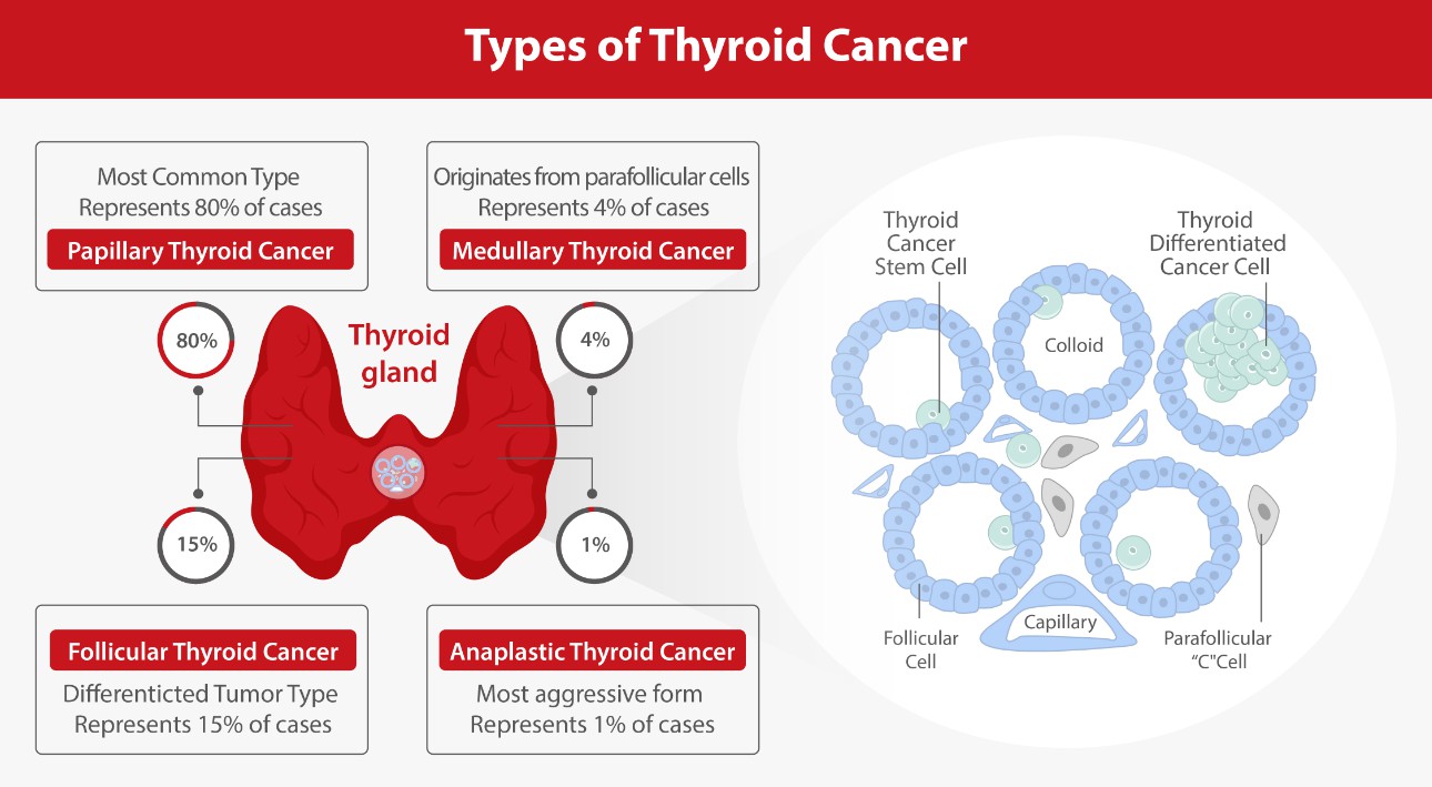 research topics thyroid cancer