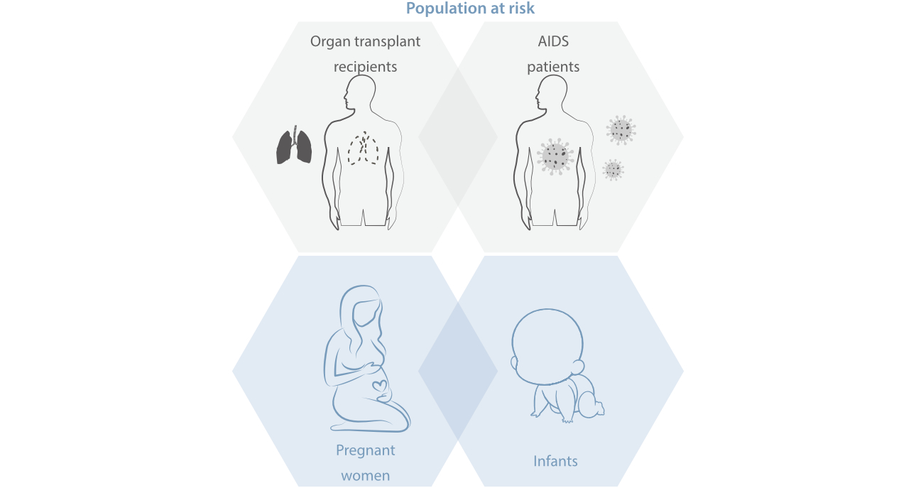 Toxoplasmosis-fig2-pc