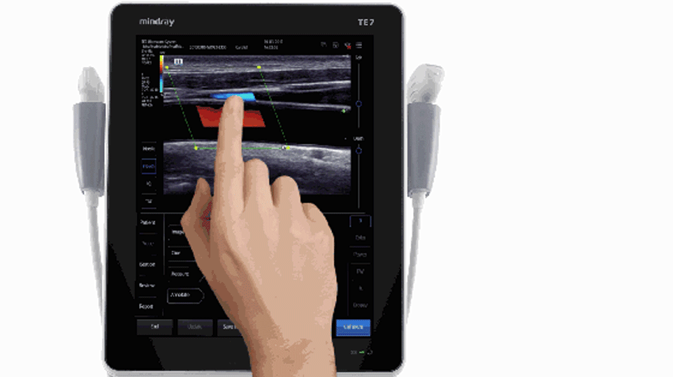 Asset download Mindray