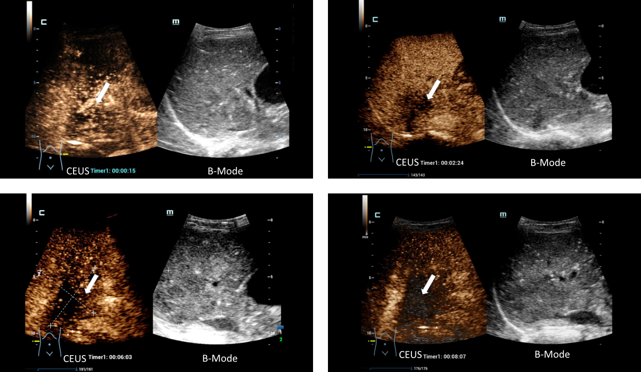 innovative-sonography-fig3-pc