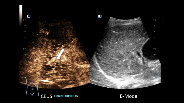 innovative-sonography-fig4-pc