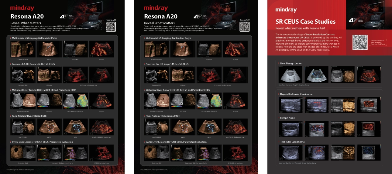 Resona A20 clinical image posters