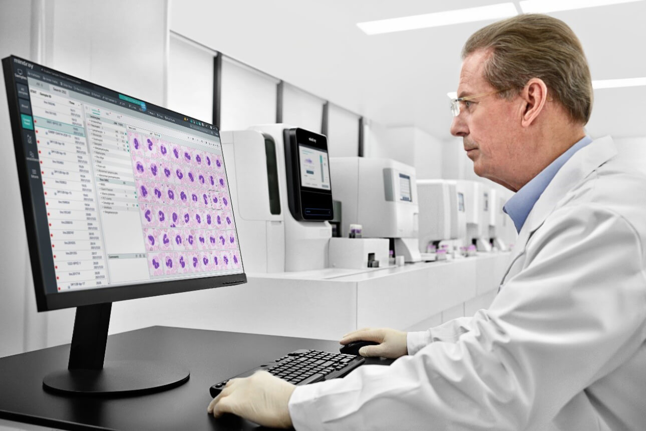 Mindray Launches New Mc 80 Automated Digital Cell Morphology Analyzer Mindray Global