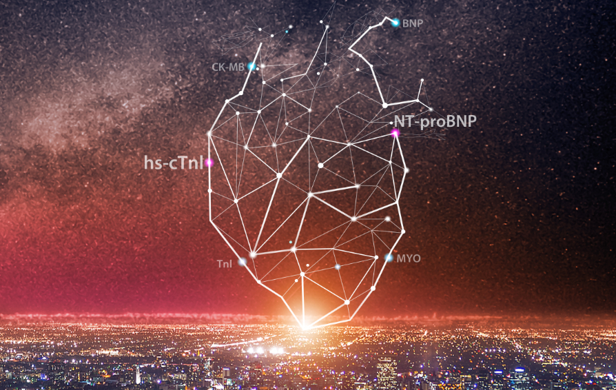 hs-ctni-nt-probnp-assays-press-kv-pc