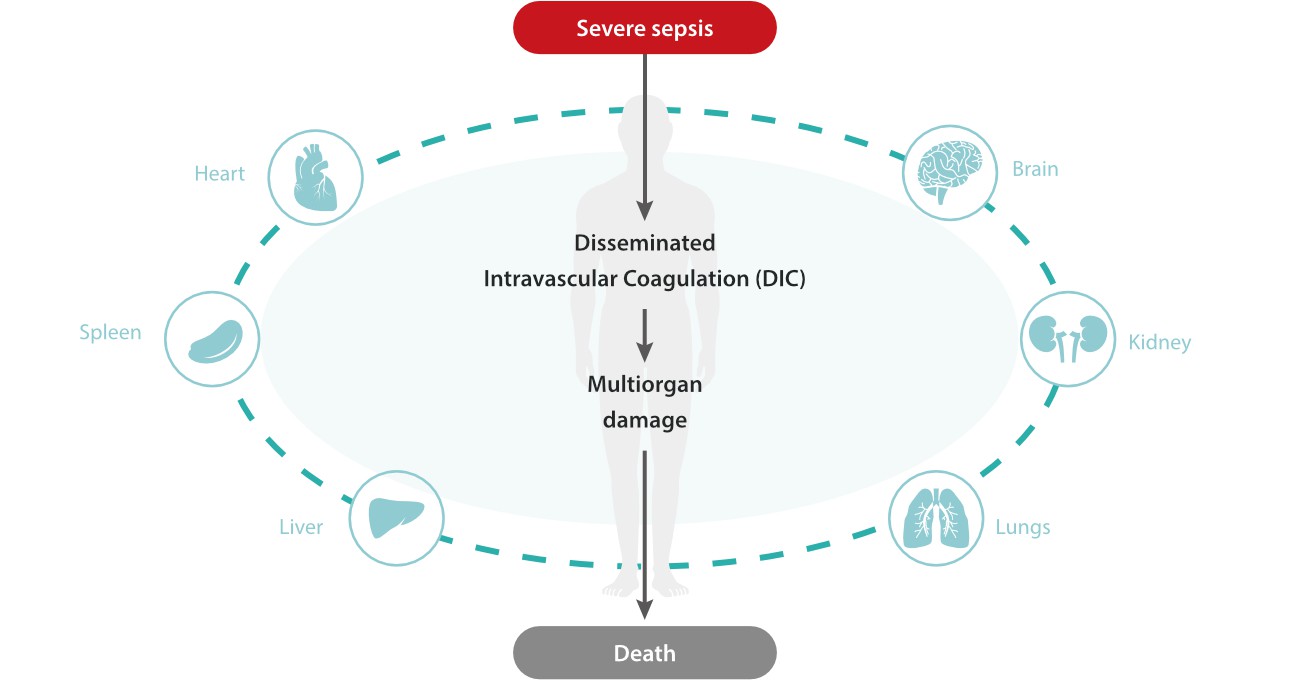 inflammation-solution-ips-fig5-pc