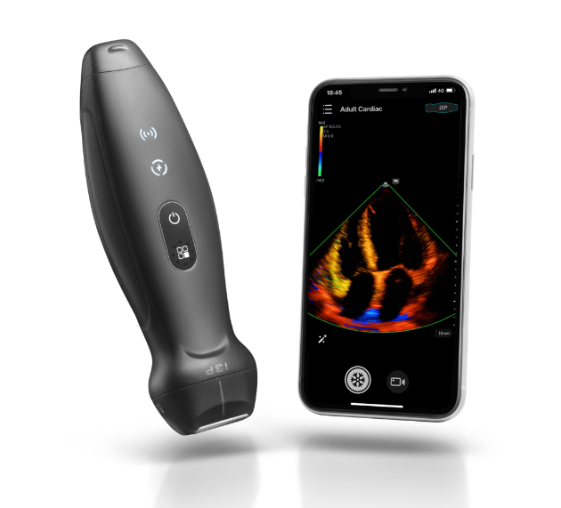 mindray wireless handheld ultrasound te air