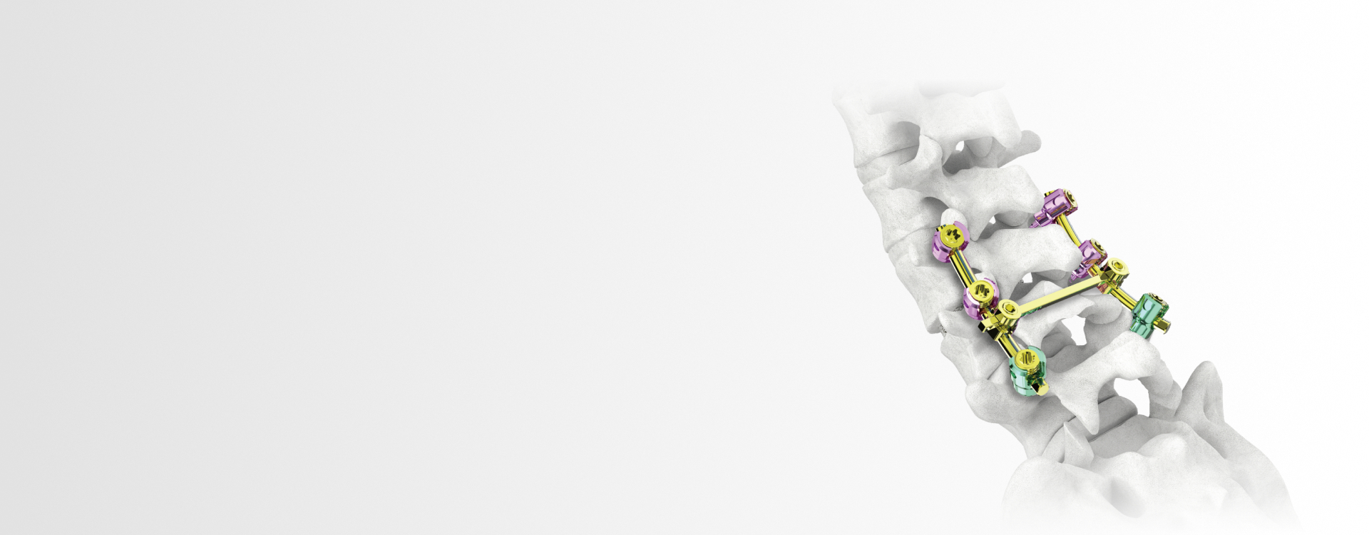 MS Posterior Pedicle Screw System product thumbnail