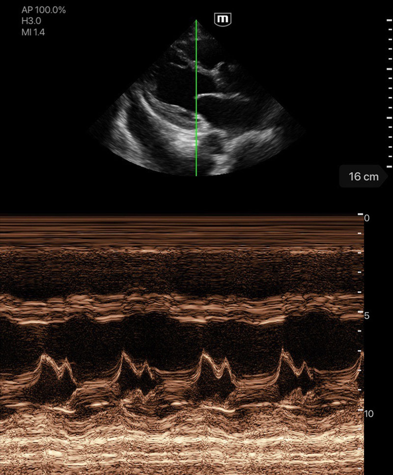 TE Air - Mindray Wireless Handheld Ultrasound System - Mindray Global