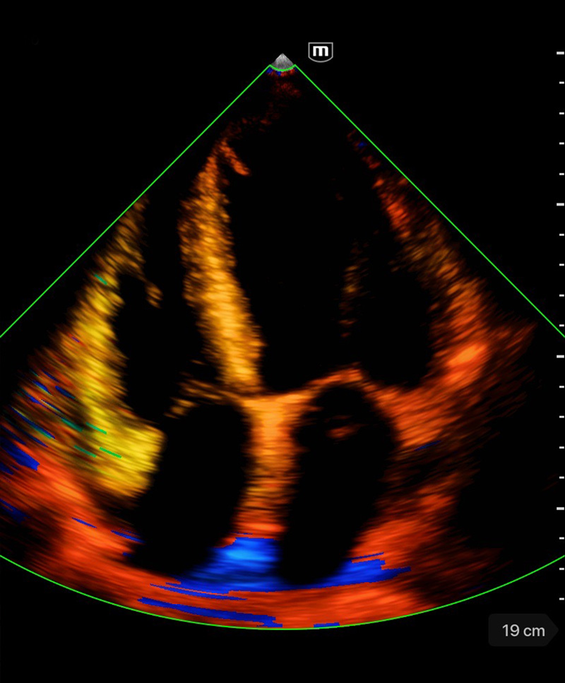 Mindray TE Air – Ultrasounds MD