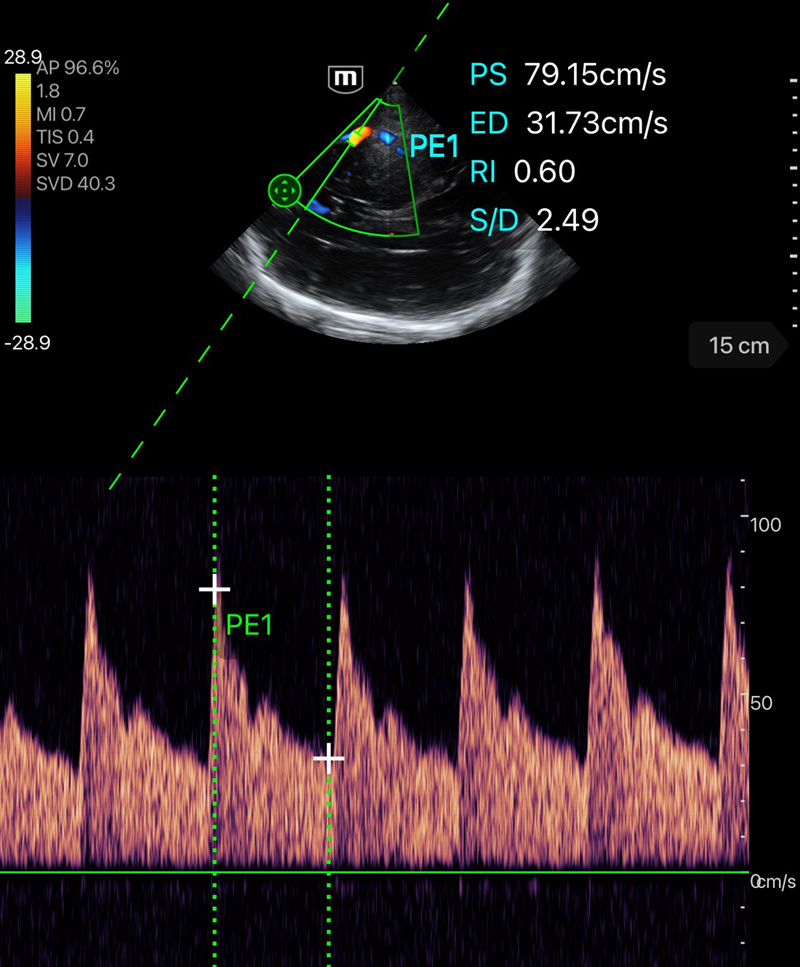 TE Air - Mindray Wireless Handheld Ultrasound System - Mindray Global