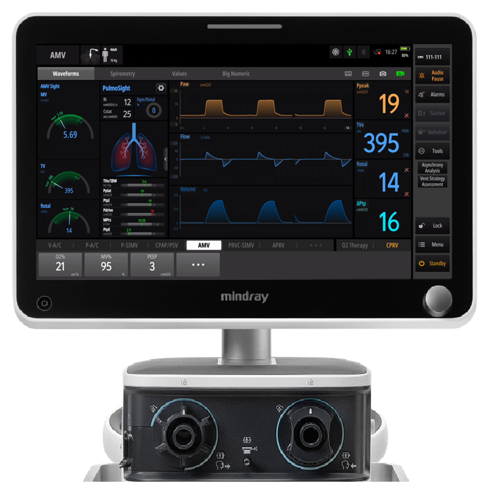 Intelligent ventilation solution interface screenshot