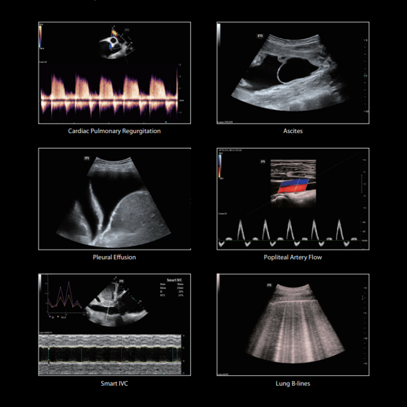 Smart tools in ultrasound 2 1340w