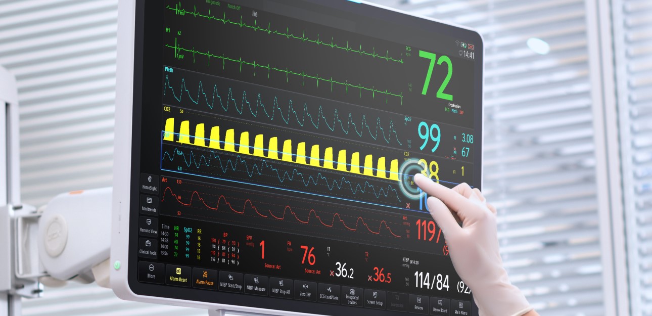 BeneVision v series-Comprehensive Visibility and Control.jpg